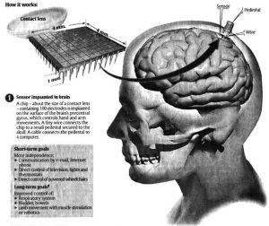 microchip-implant-on-the-brain